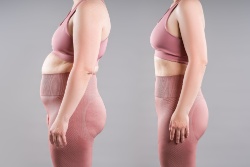 Vor und nach der Gewichtsabnahme mit GLP-1 Vor und nach der Gewichtsabnahme mit GLP-1