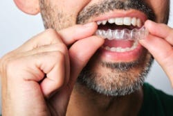 Mann mit Schnurrbart und Zahnspange Mann mit Schnurrbart und Zahnspange